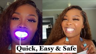 BEST Teeth Whitening at Home LED Kit THE BEST EVER  iSmile California  Real Review 2019 [upl. by Esyned]