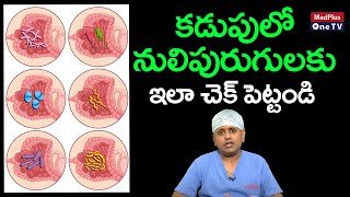 Intestinal Worms  Symptoms Treatment and Causes  DrKShiva Raju MedPlusONETV [upl. by Jill]