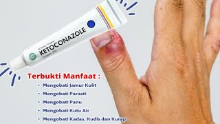 review ketoconazole krim 2 atasi gatal kulit infeksi [upl. by Teri]