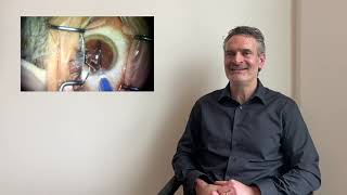 Mark S  RLE refractive lens exchange with multifocal lenses and femtosecond laser Testimonial [upl. by Cleaves]