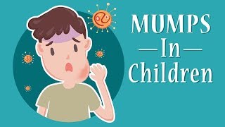 Mumps in Children  Signs Causes amp Treatment [upl. by Airyk]