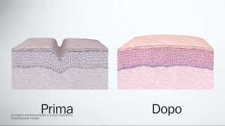 Fillerina Biorevitalizing  Trattamento effetto filler dermocosmetico ed effetto biorivitalizzante [upl. by Frolick]