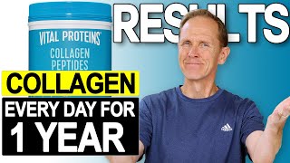 Vital Proteins Collagen Peptides  Results After One Year [upl. by Nakeber]