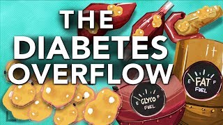 Obesity amp Diabetes Explained The Overflow Phenomenon [upl. by Onabru]