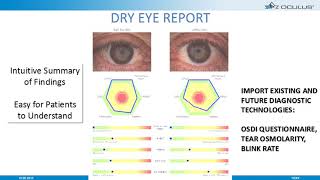 Online Seminar Erich Mack Keratograph 5M Dry Eye Technology [upl. by Ninette]