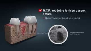 RTR Biomatériau résorbable pour la régénération osseuse [upl. by Kresic]