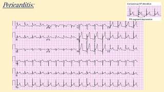 ECG interpretation NAC OSCE exam Starmed Medical Education Programs wwwmededucanadacom [upl. by Aseeral845]