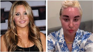 What happened to Amanda Bynes [upl. by Ezana]