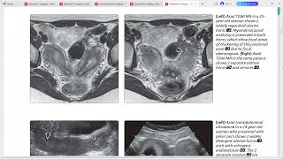 GYNAE IMAGING DIAGNOSTIC IMAGING SERIES [upl. by Jon]