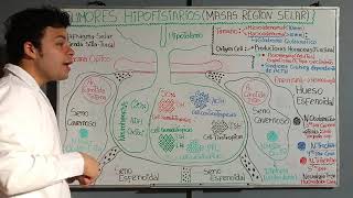 Tumores Hipofisiario o Masas de la región Sellar Glándula Pituitaria  MacroadenomaMicroadenoma [upl. by Ley164]