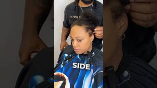 Alopecia Haircut Problem ‼️💈😩 [upl. by Relyc]