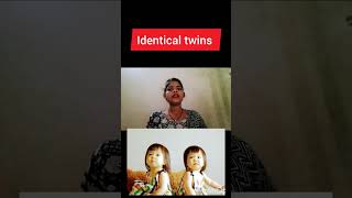 monochorionoc Diamniotic twins pregnancy kya hoti hai identical twins pregnancy dizygotic twins preg [upl. by Norina971]