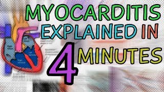 WHAT IS MYOCARDITIS MYOCARDITIS EXPLAINED IN 4 MINUTES  CAUSES SYMPTOMS DIAGNOSIS TREATMENT [upl. by Arracat]