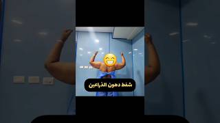 شفط دهون ليبوديما الذراعين د محمد الهيتمى arms lipidemia treatment Dr Mohamed Elhitamy [upl. by Zawde]