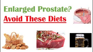 Foods to Avoid with Enlarged Prostate  Reduce Symptoms and Risk of Prostate Cancer [upl. by Gail589]