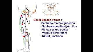 Venous hemodynamics physiopathology and treatments CFranceschi BARI 2024 [upl. by Hardej]