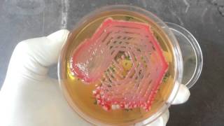 Hafnia alvei and Pink pigmented colony of S marcescens on MHA plat [upl. by Yesima483]