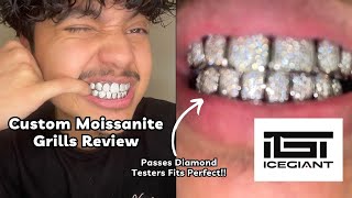 CUSTOM MOISSANITE DIAMOND GRILLZ FROM THE ICEGIANT REVIEW [upl. by Lorne]