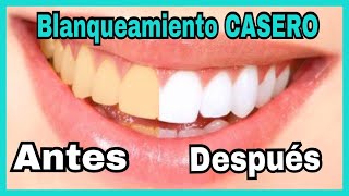 BLANQUEA TUS DIENTES EN MINUTOS  3 REMEDIOS CASEROS  NatyGloss [upl. by Dieball]