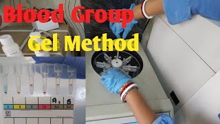 Blood Group Test By Gel Method  Forward Blood Grouping Gel Technology [upl. by Bortman]