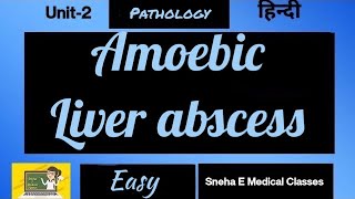 Amoebic Liver abscess  Pathology [upl. by Kopple]