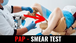 Pap  smear test [upl. by Vania]