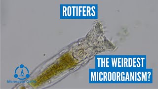 Rotifers under the microscope these things are so weird [upl. by Ezitram]