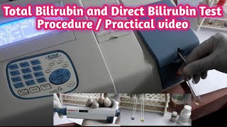 Total Bilirubin and Direct Bilirubin Test Procedure Practical Video [upl. by Reham160]