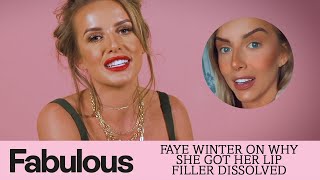 Love Islands Faye Winter on getting her lip filler dissolved [upl. by Enirod47]