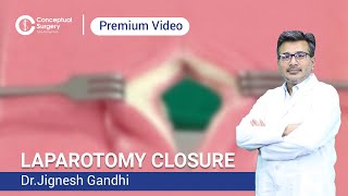 Laparotomy Closure Dr Jignesh Gandhi [upl. by Rehpotirhc]