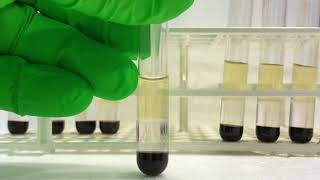 Isolation of peripheral blood mononuclear cells PBMCs from small volume of blood [upl. by Patrich]