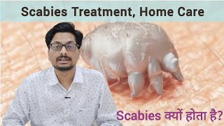 Scabies क्यों होता है स्केबीज रात की खुजली कारण और इलाज़  Scabies Treatment Home Care scabies [upl. by Leith250]