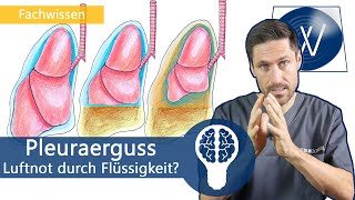 Pleuraerguss amp Luftnot Ursachen amp Symptome für zuviel Flüssigkeit im Pleuraspalt  Medizinwissen [upl. by Aelahs]