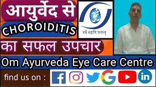 Choroiditis Ayurveda Eye Treatments [upl. by Matejka]