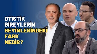 Otistik Bireylerin Beyinlerindeki Fark Nedir [upl. by Tatiania335]