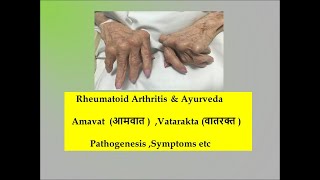 Rheumatoid Arthritis l Ayurveda l Amavata l vatarakta l stages of RA l Pathogenesis l samprapti [upl. by Broderick566]