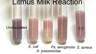 Litmus Milk Test  Amrita University [upl. by Auberbach624]