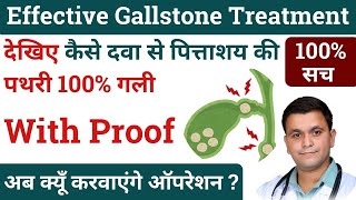 Gallstones homeopathic medicine Gallstones homeopathic treatment Gallstone homeopathy RxHpathy [upl. by Glenna]