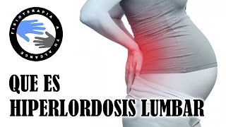 Hiperlordosis lumbar que es y porque se produce [upl. by Naliorf]