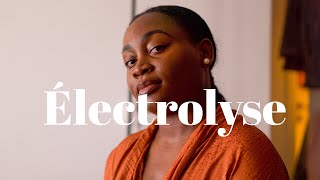 ELECTROLYSE  Epilation définitive  Deux ans après en suis je satisfaite [upl. by Septima]