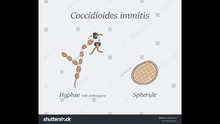 coccidiodes immitis sketchy videousmleprep exam usmlestep2usmlecoaching usmlejourneychemistry [upl. by Milde]