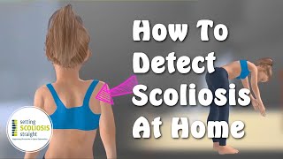 How to Detect Scoliosis at Home  Explained Under 1 minute [upl. by Lucille]