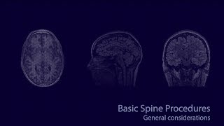 Basic neuroradiology procedures part 1  General considerations [upl. by Atsirk23]