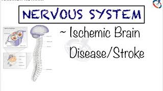 Ischemic Brain DiseaseStroke  Nervous System Pathology by Aakansh Kothari [upl. by Manley]