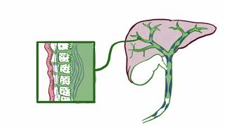 Primary sclerosing cholangitis causes symptoms diagnosis treatment amp pathology [upl. by Irac]