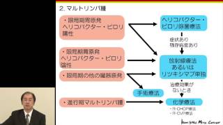 No6 悪性リンパ腫の治療について 福島 伯泰 [upl. by Michel]