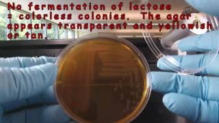 MacConkey Agar [upl. by Ellehcan6]