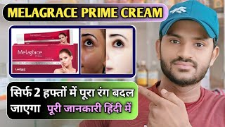 Melagrace prime cream use dose benefits and side effect Full review in hindi [upl. by Akenet456]