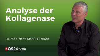 Prädetektive Diagnostik Krankheiten vorhersagen durch aMMP8  Dr med dent Markus Schadt  QS24 [upl. by Conlin]