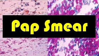 Pap Smear  Pap Test  Pap Smear Procedure  The Role of Pap Smear in Cervical Screening [upl. by Nasar]